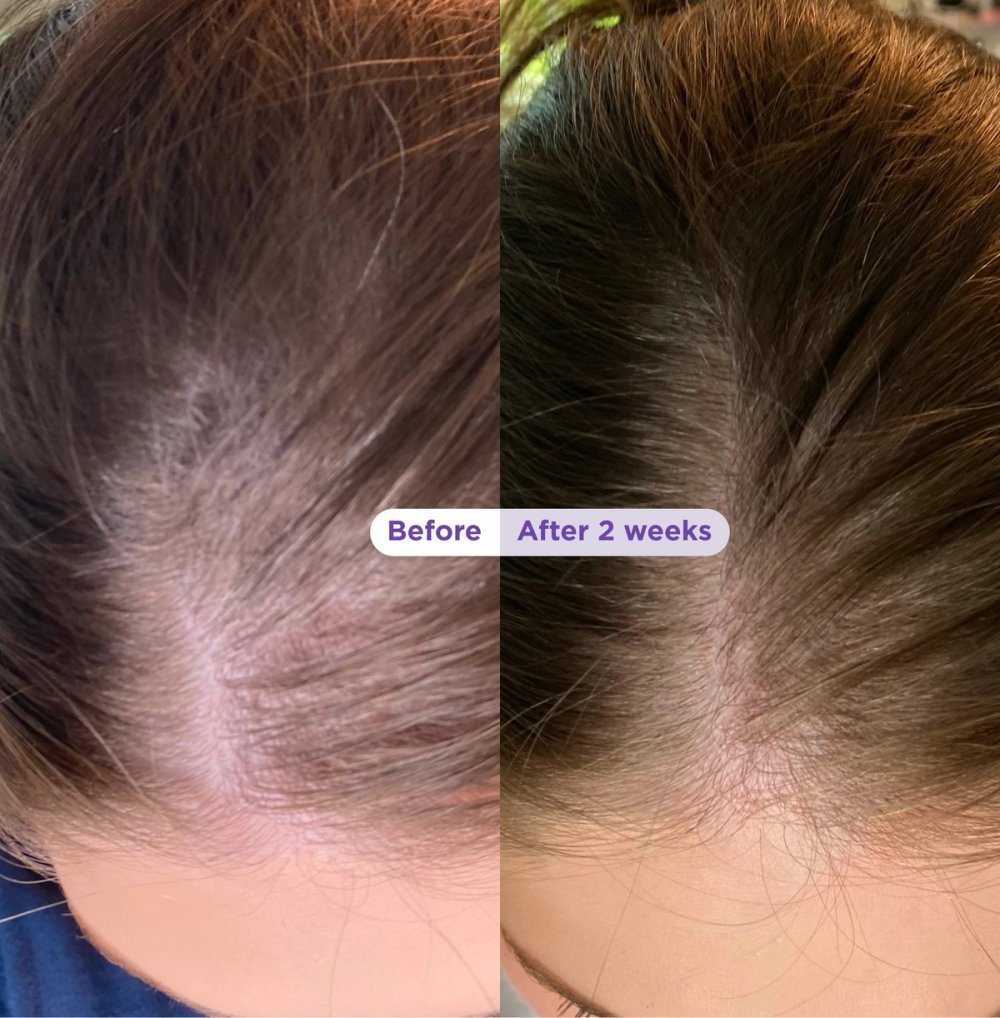 Visible hair results