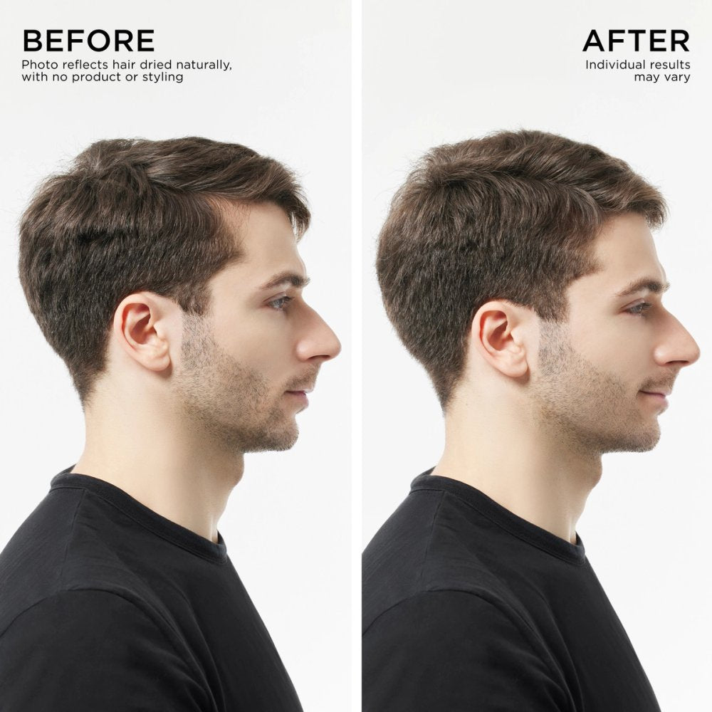 Visible hair results