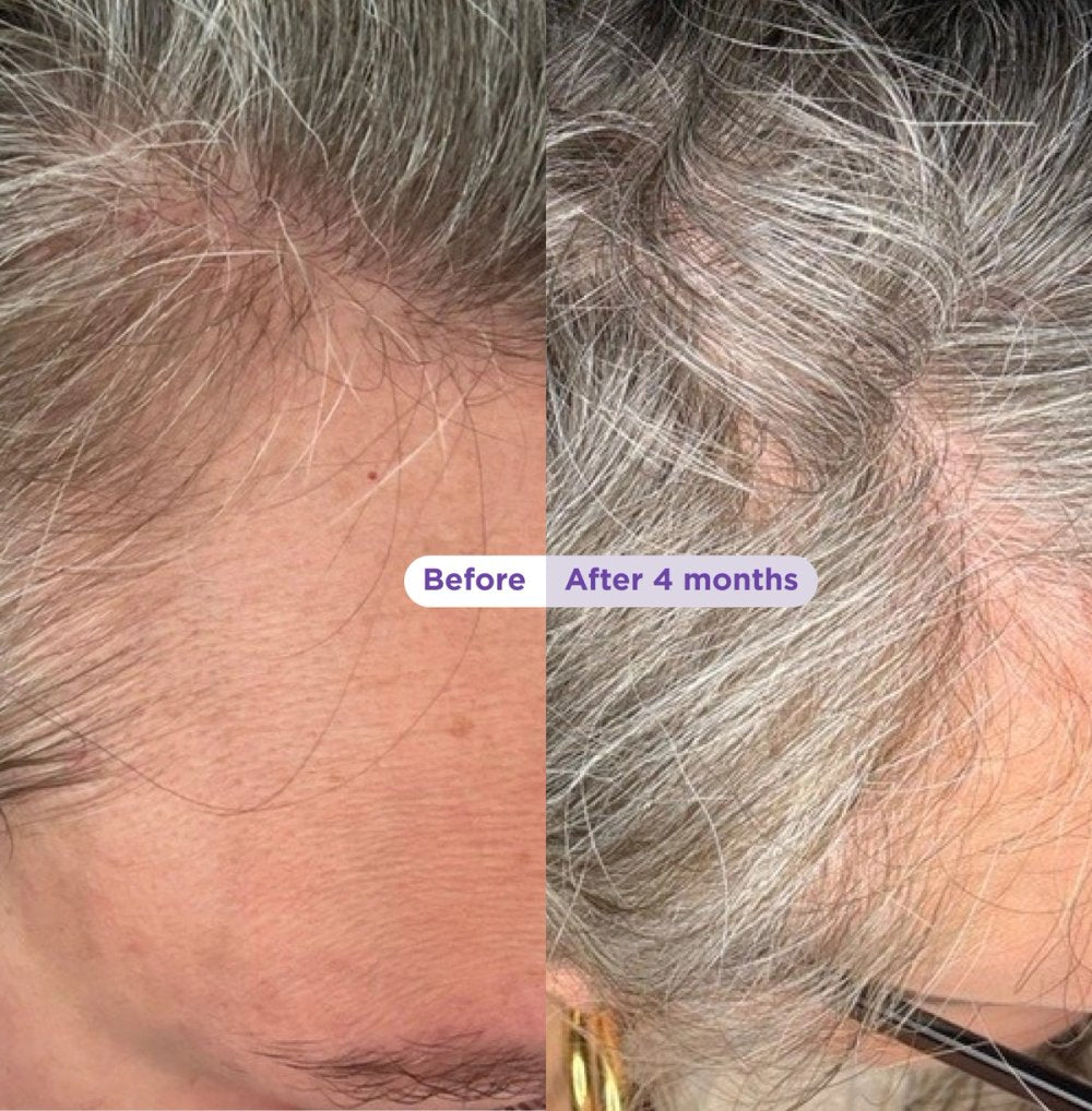 Visible hair results
