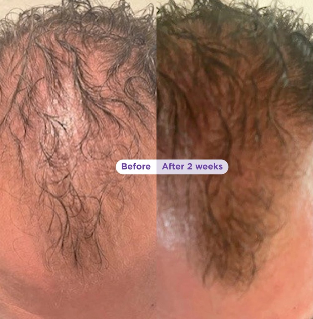 Visible hair results