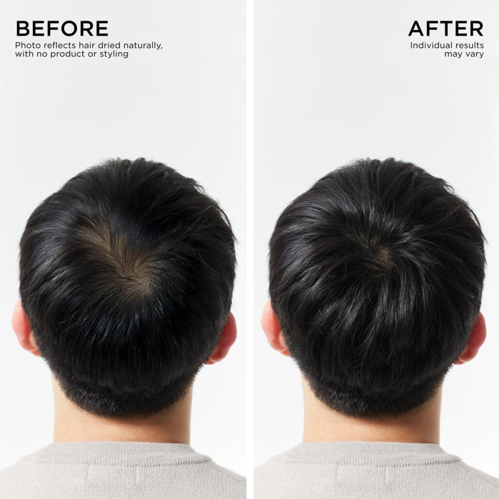 Visible hair results
