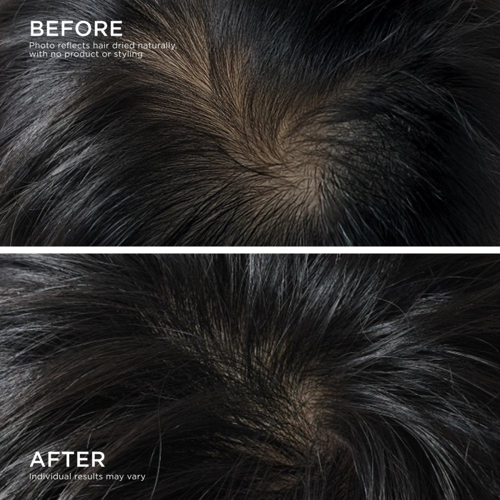 Visible hair results